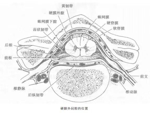  硬膜外镇痛技术原理解析：为什么无痛分娩不会让你“腰疼”？ 健康养生